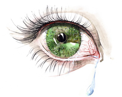 Steroid eye drops after lasik surgery