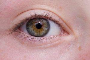 glaucoma testing, diganosis and treatment